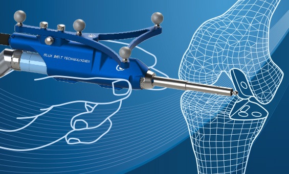 navio robotic surgery