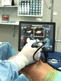 Robotic Assisted Partial Knee Surgery